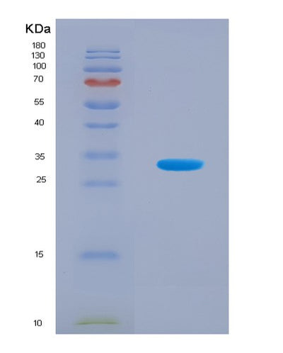 SDS-PAGE analysis of Human SNRPC (U1 Small Nuclear Ribonucleoprotein C) - Recombinant Protein, CAT# BLT-08853P showing >90% purity under 15% SDS-PAGE (Reduced)Human SNRPC (U1 Small Nuclear Ribonucleoprotein C) - Recombinant Protein