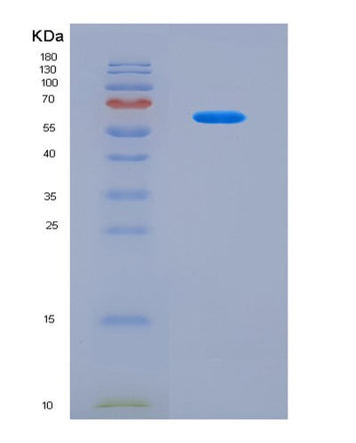 SDS-PAGE analysis of Human RNASE3 (Eosinophil Cationic Protein) - Recombinant Protein, CAT# BLT-08816P showing >90% purity under 15% SDS-PAGE (Reduced)Human RNASE3 (Eosinophil Cationic Protein) - Recombinant Protein