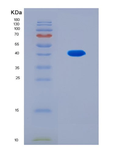 SDS-PAGE analysis of Human ITPR3 (Inositol 1,4,5-Trisphosphate-Gated Calcium Channel Itpr3) - Recombinant Protein, CAT# BLT-08914P showing >90% purity under 15% SDS-PAGE (Reduced)Human ITPR3 (Inositol 1,4,5-Trisphosphate-Gated Calcium Channel Itpr3) - Recombinant Protein