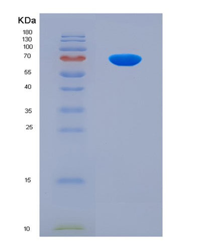SDS-PAGE analysis of Human YAP1 (Transcriptional Coactivator Yap1) - Recombinant Protein, CAT# BLT-08640P showing >90% purity under 15% SDS-PAGE (Reduced)Human YAP1 (Transcriptional Coactivator Yap1) - Recombinant Protein