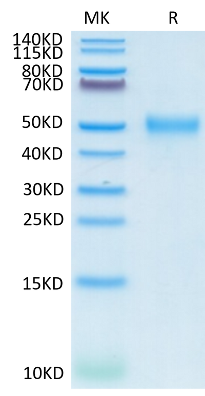 Cynomolgus CD24 on Tris-Bis PAGE under reduced conditions. The purity is greater than 95%.Recombinant Cynomolgus CD24 Protein