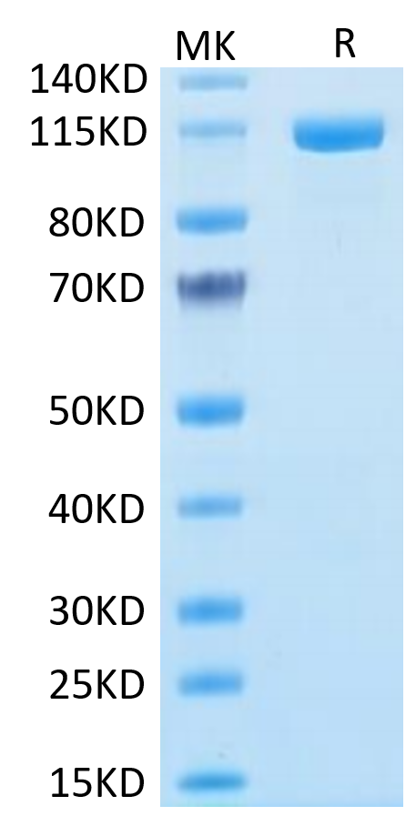 Human FAP on Tris-Bis PAGE under reduced condition. The purity is greater than 95%.Recombinant Human FAP Protein, Active