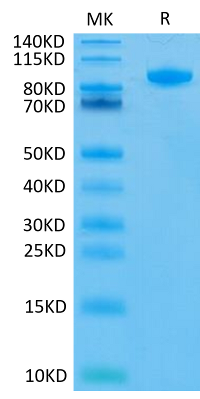 Human FAP on Tris-Bis PAGE under reduced conditions. The purity is greater than 95%.Recombinant Human FAP Protein, Active