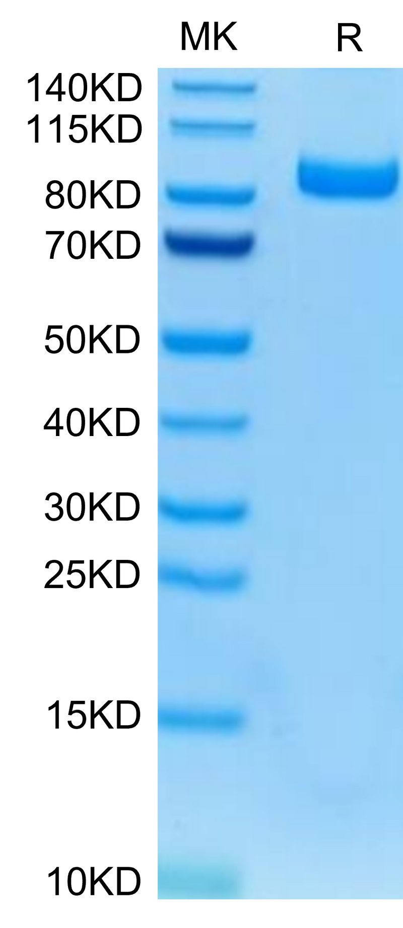 Mouse FAP on Tris-Bis PAGE under reduced conditions. The purity is greater than 95%.Recombinant Mouse FAP Protein, Active
