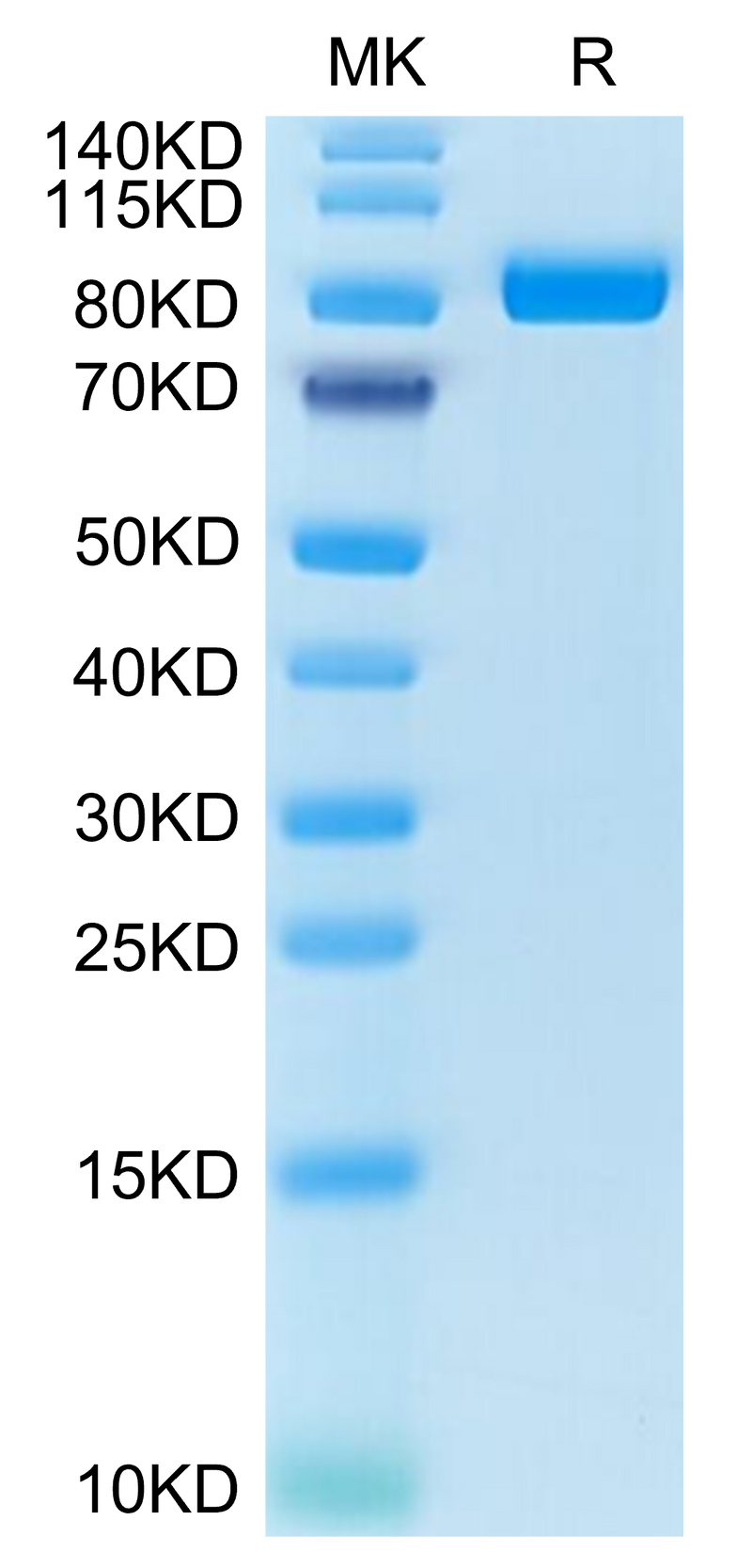 Cynomolgus FAP on Tris-Bis PAGE under reduced condition. The purity is greater than 95%.Recombinant Cynomolgus FAP Protein, Active