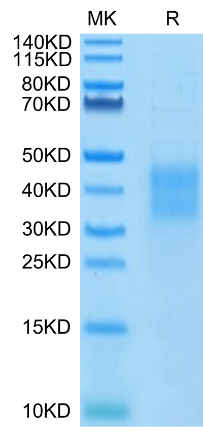 Human HVEM on Tris-Bis PAGE under reduced condition. The purity is greater than 95%.Recombinant Human HVEM/TNFRSF14 Protein, Active