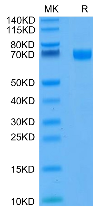 FITC-Compatible Human CD19 on Tris-Bis PAGE under reduced condition. The purity is greater than 95%.Recombinant FITC-Compatible Human CD19 Protein