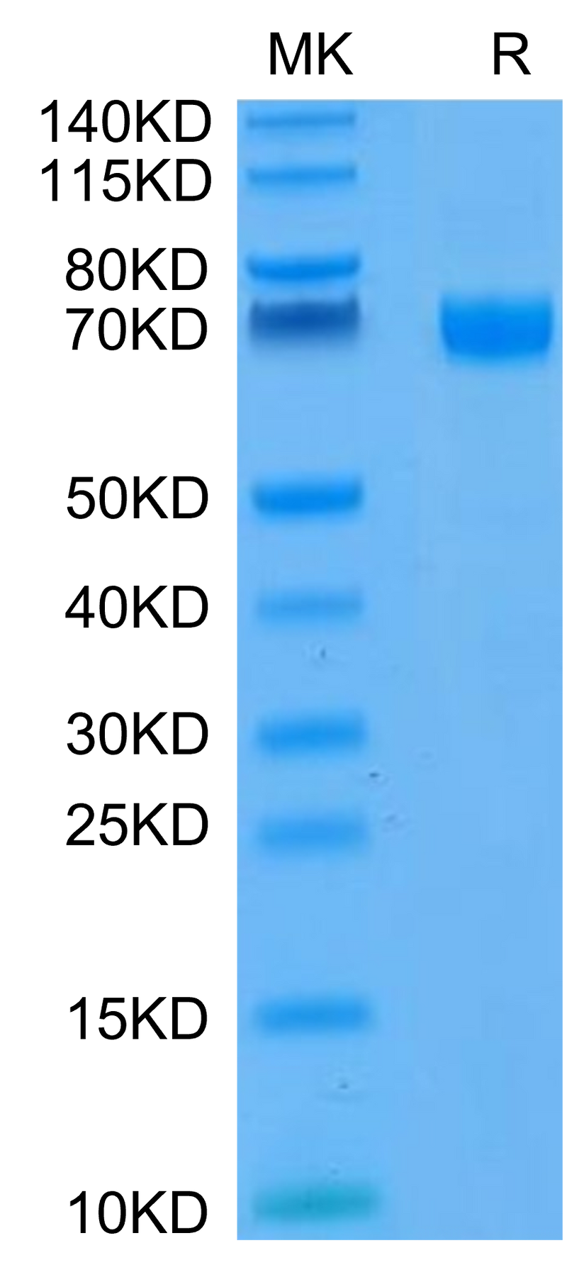 FITC-Compatible Human CD19 on Tris-Bis PAGE under reduced condition. The purity is greater than 95%.