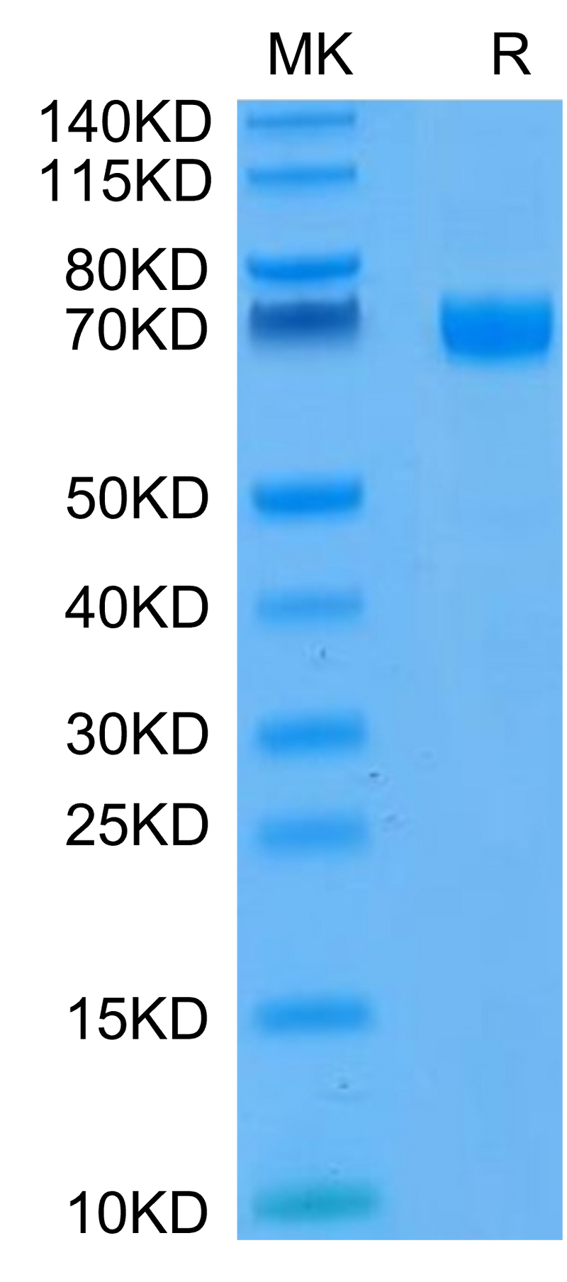 FITC-Compatible Human CD19 on Tris-Bis PAGE under reduced condition. The purity is greater than 95%.Recombinant FITC-Compatible Human CD19 Protein