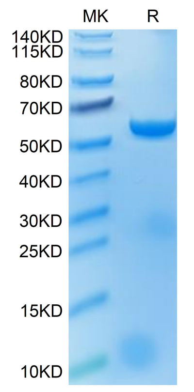Biotinylated Human HLA-A*02:01&B2M&MAGE-A4 (GVYDGREHTV) Monomer on Tris-Bis PAGE under reduced condition. The purity is greater than 95%.Biotinylated Human HLA-A*02:01&B2M&MAGE-A4 (GVYDGREHTV) Monomer Protein, Active