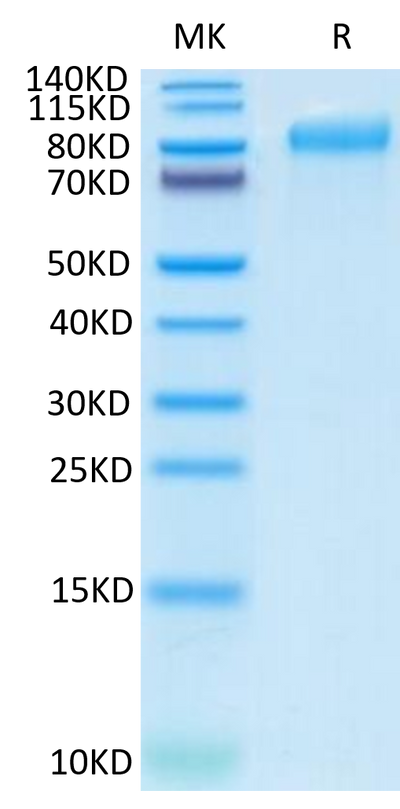 Human ITGB6 on Tris-Bis PAGE under reduced condition. The purity is greater than 95%.Recombinant Human ITGB6 Protein