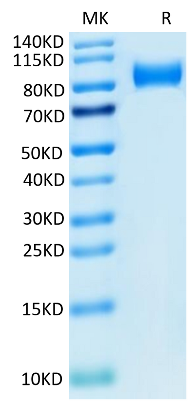 Mouse ITGB6 on Tris-Bis PAGE under reduced condition. The purity is greater than 95%.Recombinant Mouse ITGB6 Protein