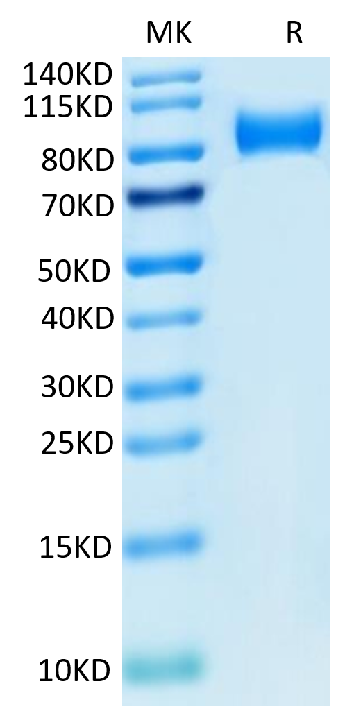Mouse ITGB6 on Tris-Bis PAGE under reduced condition. The purity is greater than 95%.Recombinant Mouse ITGB6 Protein