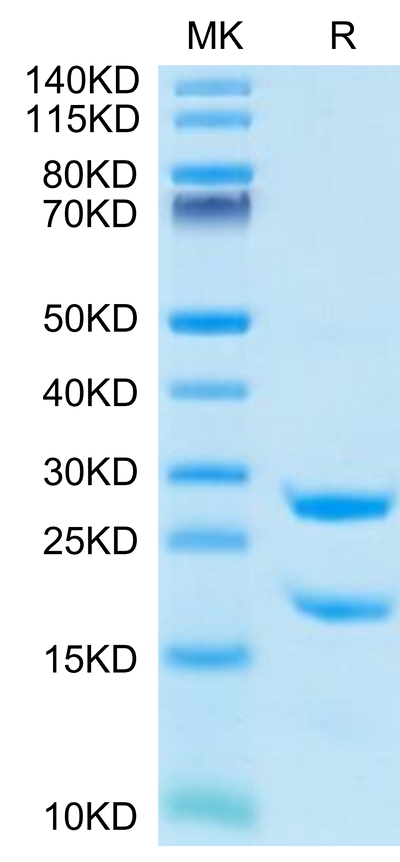 Rat MASP2 on Tris-Bis PAGE under reduced condition. The purity is greater than 95%.Recombinant Rat MASP2 Protein, Active