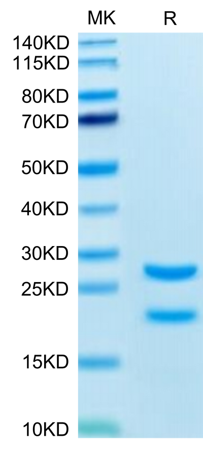 Biotinylated Rat MASP2 on Tris-Bis PAGE under reduced condition. The purity is greater than 95%.Biotinylated Rat MASP2 Protein (Primary Amine Labeling), Active