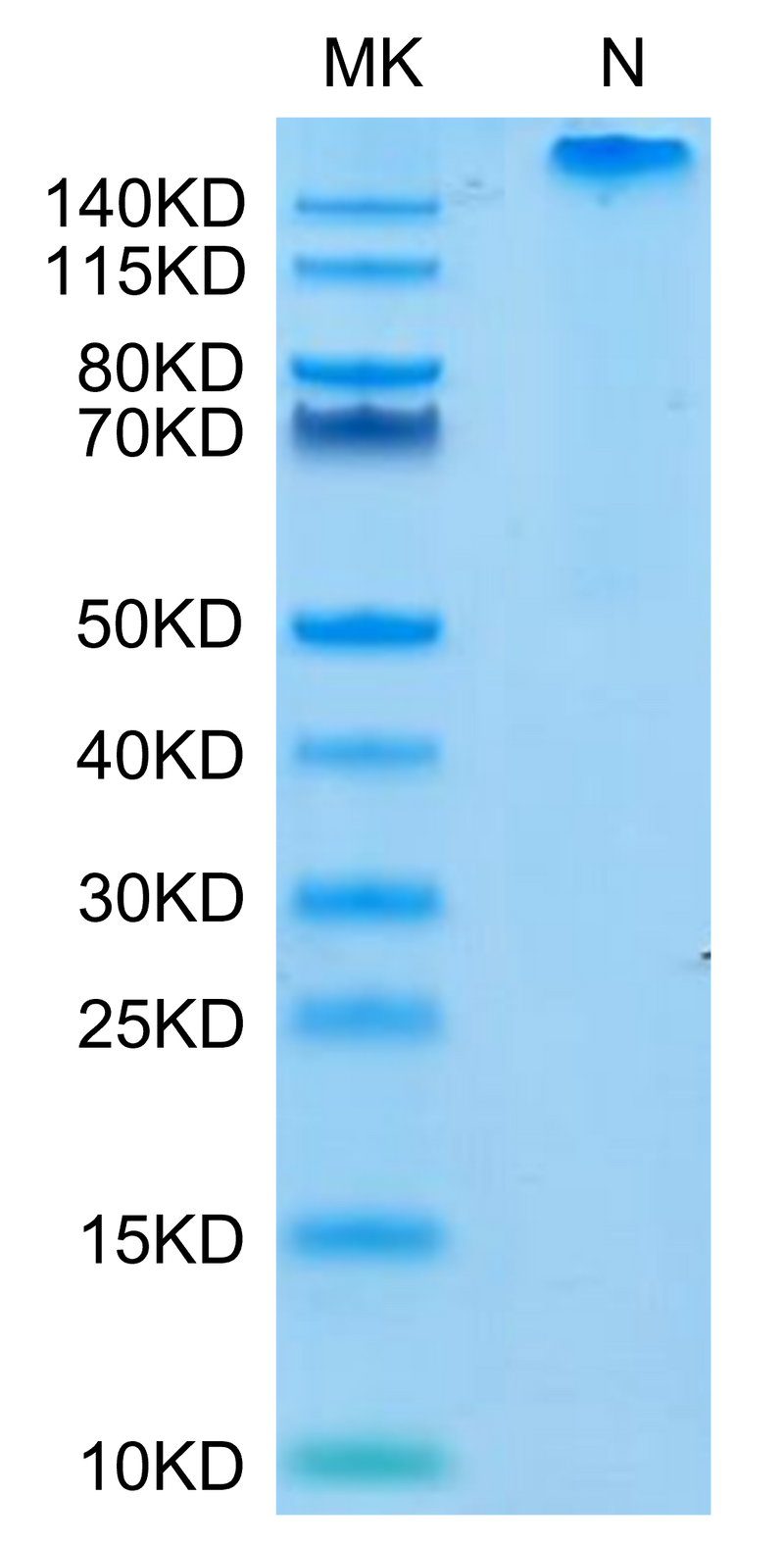 Human HLA-E*01:03&B2M&Peptide (VMAPRTLVL) Tetramer on Tris-Bis PAGE under Non reducing (N) condition. The purity is greater than 95%.Recombinant Human HLA-E*01:03&B2M&Peptide (VMAPRTLVL) Tetramer Protein, Active
