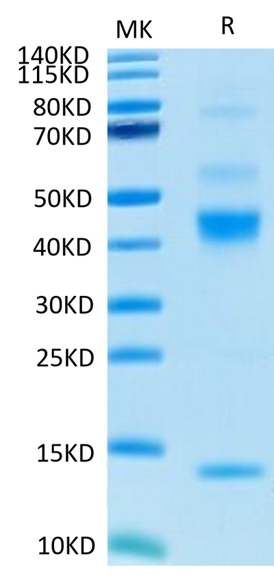 Human Latent TGF beta 1 on Tris-Bis PAGE under reduced condition. The purity is greater than 95%.Recombinant Human Latent TGF beta 1/TGFB1 Protein, Active