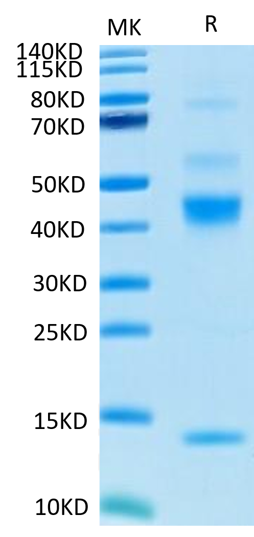 Human Latent TGF beta 1 on Tris-Bis PAGE under reduced condition. The purity is greater than 95%.Recombinant Human Latent TGF beta 1/TGFB1 Protein, Active