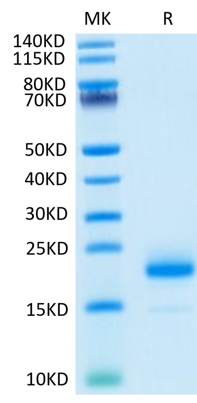 Human IL-4 on Tris-Bis PAGE under reduced condition. The purity is greater than 95%.Recombinant Human IL-4 Protein, Active