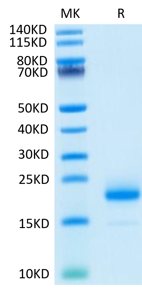 Human IL-4 on Tris-Bis PAGE under reduced condition. The purity is greater than 95%.Recombinant Human IL-4 Protein, Active