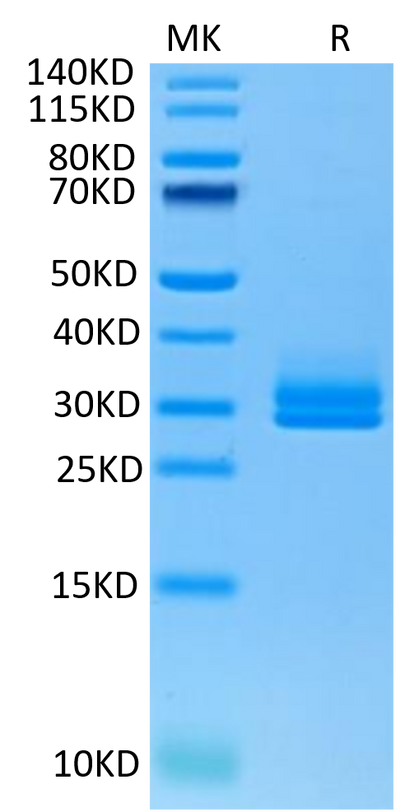 Human ANGPTL2 on Tris-Bis PAGE under reduced condition. The purity is greater than 95%.Recombinant Human ANGPTL2/Angiopoietin-like 2 Protein, Active