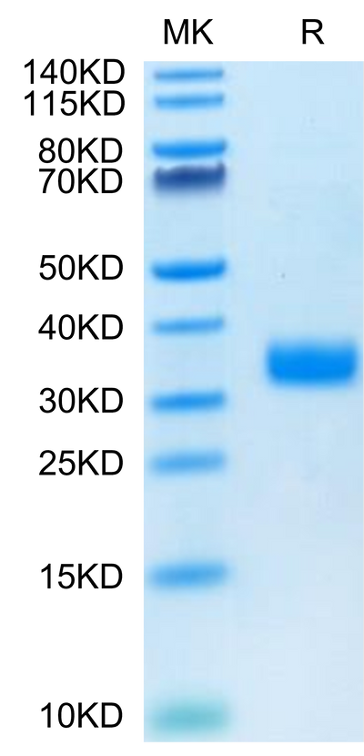 Human Angiopoietin-like 4 on Tris-Bis PAGE under reduced condition. The purity is greater than 95%.Recombinant Human ANGPTL4/Angiopoietin-like 4 Protein, Active