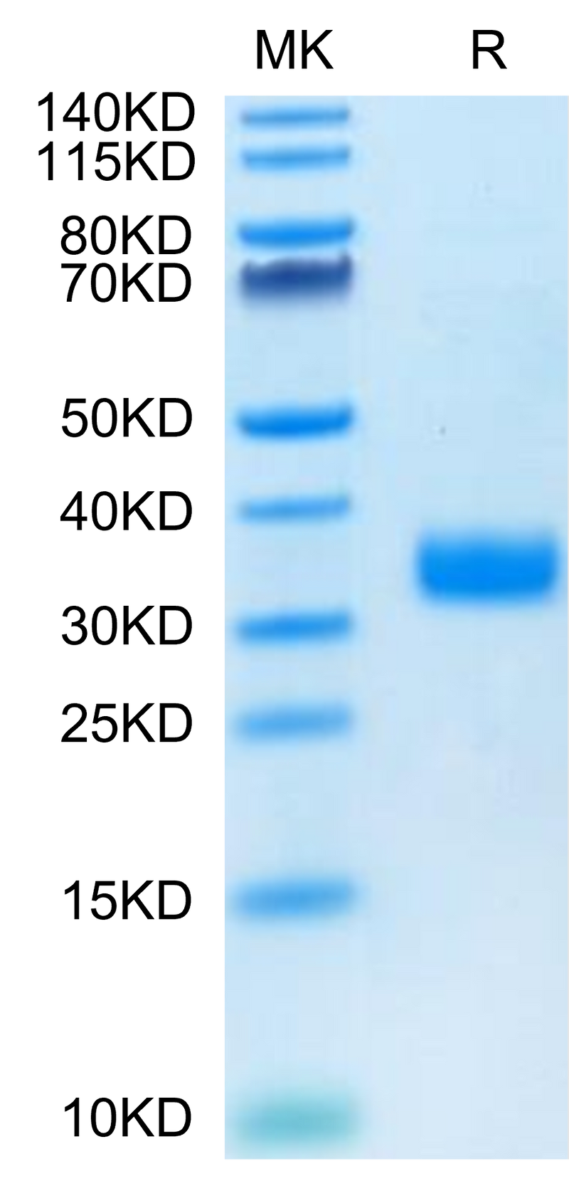 Human Angiopoietin-like 4 on Tris-Bis PAGE under reduced condition. The purity is greater than 95%.Recombinant Human ANGPTL4/Angiopoietin-like 4 Protein, Active
