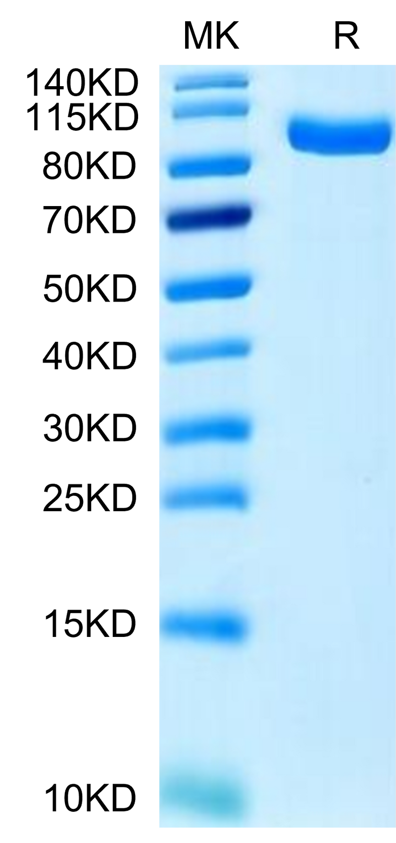 Human PTK7 on Tris-Bis PAGE under reduced condition. The purity is greater than 95%.Recombinant Human PTK7/CCK4 Protein