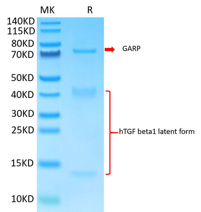 Biotinylated Human GARP&Latent TGF beta 1 Complex on Tris-Bis PAGE under reduced condition. The purity is greater than 95%.Biotinylated Human GARP&Latent TGF beta 1 Complex Protein, Active