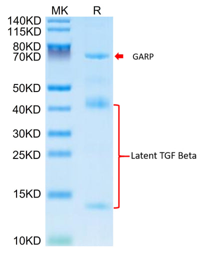 Mouse GARP&Latent TGF beta 1 Complex on Tris-Bis PAGE under reduced condition. The purity is greater than 95%.Recombinant Mouse GARP&Latent TGF beta 1 Complex Protein