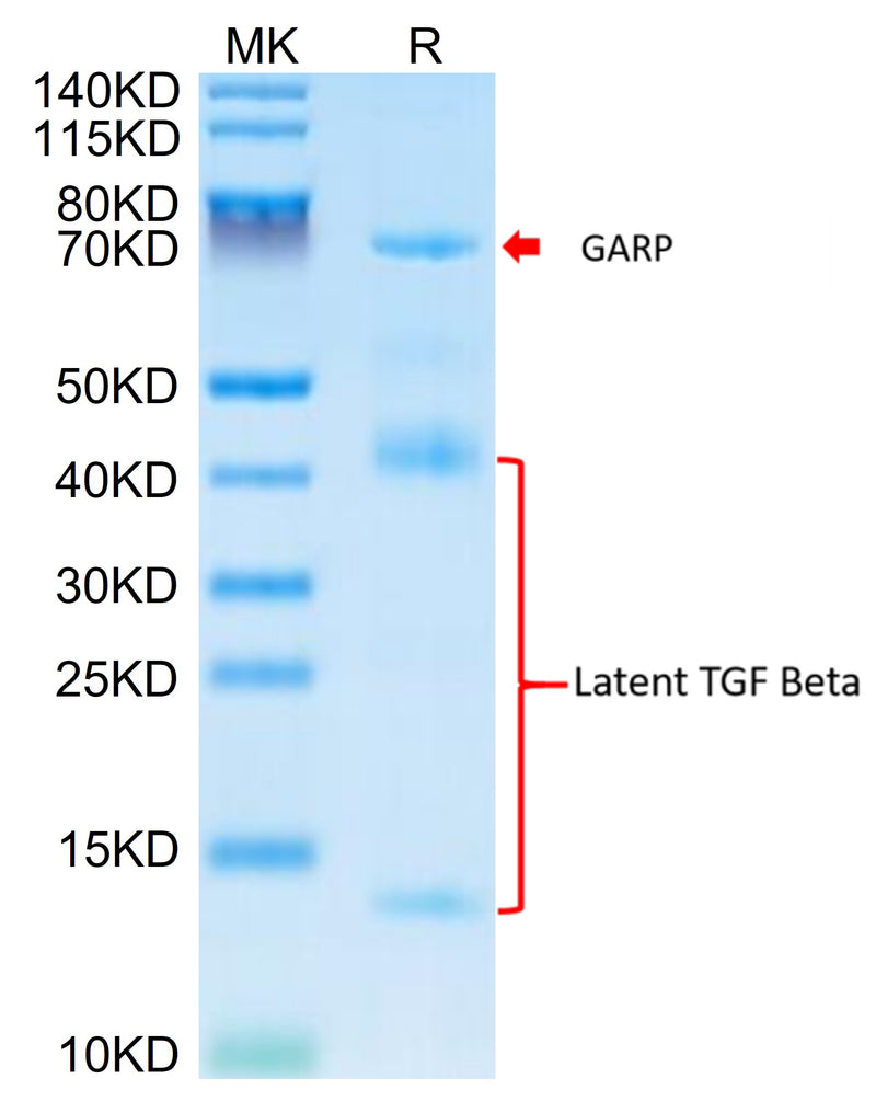 Mouse GARP&Latent TGF beta 1 Complex on Tris-Bis PAGE under reduced condition. The purity is greater than 95%.Recombinant Mouse GARP&Latent TGF beta 1 Complex Protein