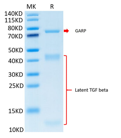Cynomolgus GARP&Latent TGF beta 1 Complex on Tris-Bis PAGE under reduced condition. The purity is greater than 95%.Recombinant Cynomolgus GARP&Latent TGF beta 1 Complex Protein, Active