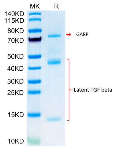 Biotinylated Mouse GARP&Latent TGF beta 1 Complex on Tris-Bis PAGE under reduced condition. The purity is greater than 95%.Biotinylated Mouse GARP&Latent TGF beta 1 Complex Protein, Active