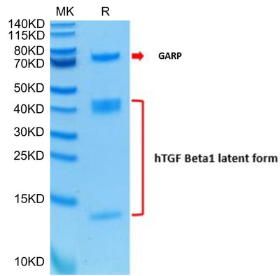 Human GARP&Latent TGF Beta 1 Complex on Tris-Bis PAGE under reduced condition. The purity is greater than 95%.Recombinant Human GARP&Latent TGF Beta 1 Complex Protein, Active