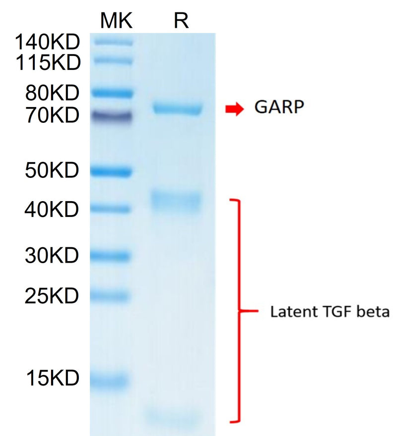 Biotinylated Cynomolgus GARP&Latent TGF beta 1 Complex on Tris-Bis PAGE under reduced condition. The purity is greater than 95%.Biotinylated Cynomolgus GARP&Latent TGF beta 1 Complex Protein, Active