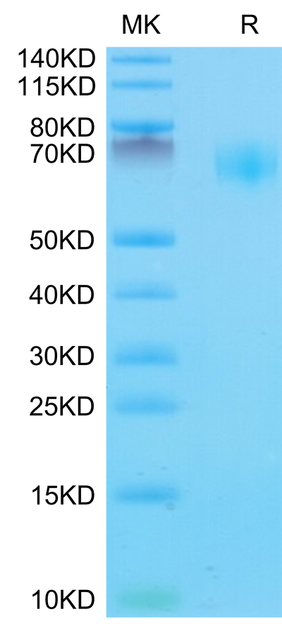 Mouse IL-18BP on Tris-Bis PAGE under reduced condition. The purity is greater than 95%.Recombinant Mouse IL-18BP Protein, Active