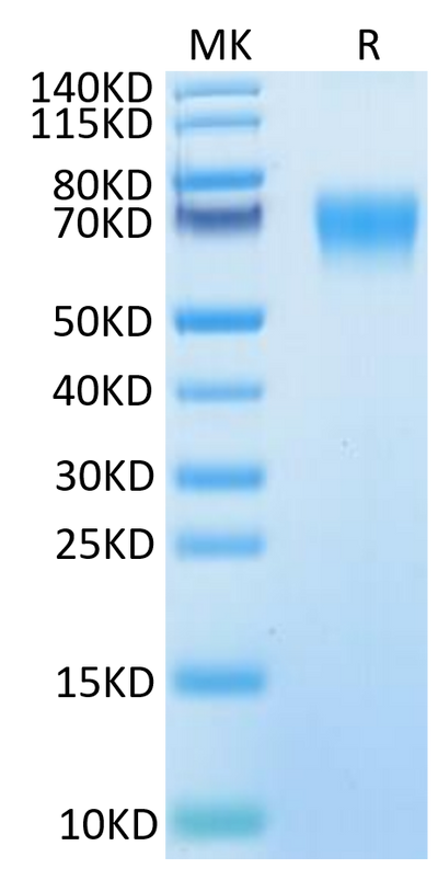 Human IL-18BP on Tris-Bis PAGE under reduced condition. The purity is greater than 95%.Recombinant Human IL-18BP Protein, Active