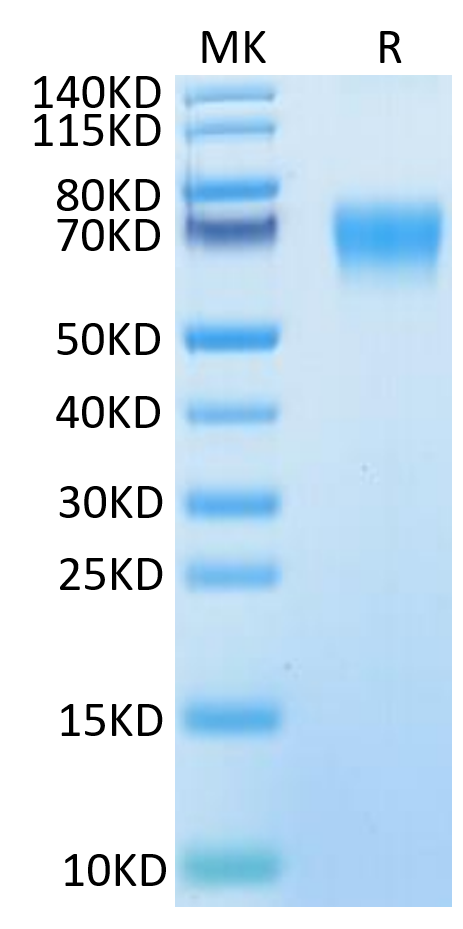Human IL-18BP on Tris-Bis PAGE under reduced condition. The purity is greater than 95%.Recombinant Human IL-18BP Protein, Active