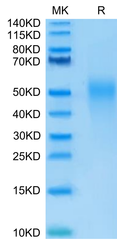 Human IL-18BP on Tris-Bis PAGE under reduced condition. The purity is greater than 95%.Recombinant Human IL-18BP Protein, Active