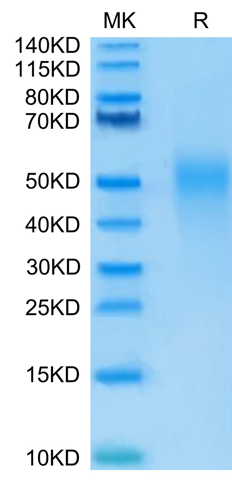 Human IL-18BP on Tris-Bis PAGE under reduced condition. The purity is greater than 95%.Recombinant Human IL-18BP Protein, Active