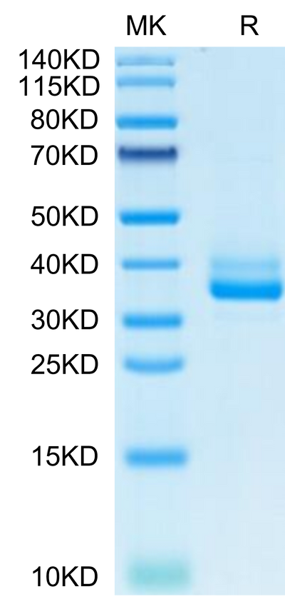 Mouse IgE on Tris-Bis PAGE under reduced condition. The purity is greater than 95%.Recombinant Mouse IgE Protein