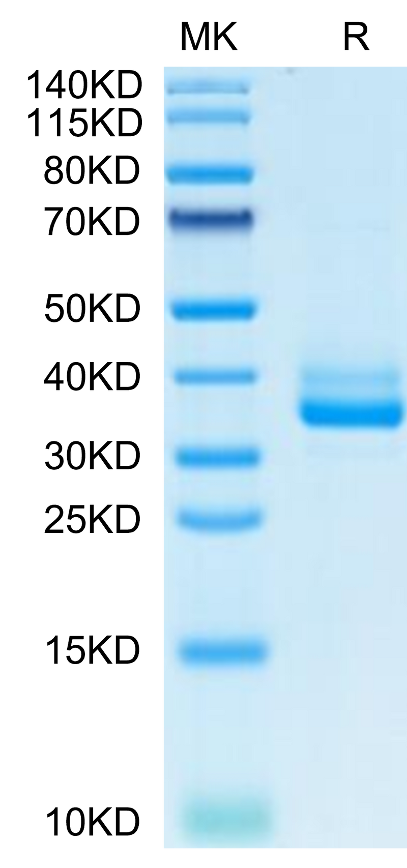 Mouse IgE on Tris-Bis PAGE under reduced condition. The purity is greater than 95%.Recombinant Mouse IgE Protein