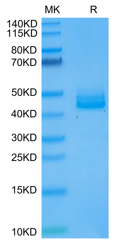 Human IL-12B on Tris-Bis PAGE under reduced condition. The purity is greater than 95%.Recombinant Human IL-12B/p40/NKSF2 Protein, Active