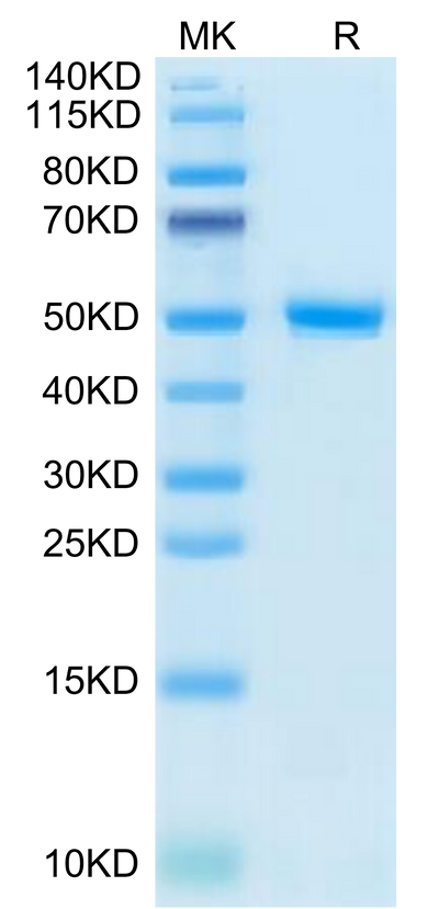 Human CD99 on Tris-Bis PAGE under reduced condition. The purity is greater than 95%.Recombinant Human CD99/MIC2 Protein