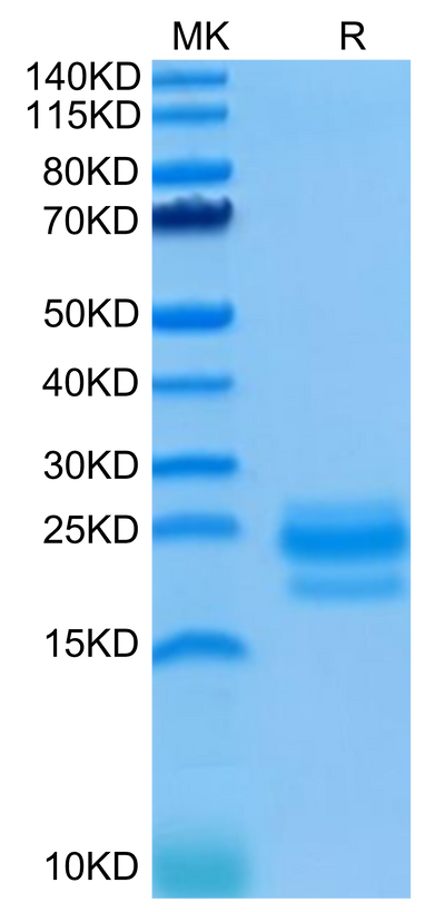 Human CD99 on Tris-Bis PAGE under reduced condition. The purity is greater than 95%.Recombinant Human CD99/MIC2 Protein