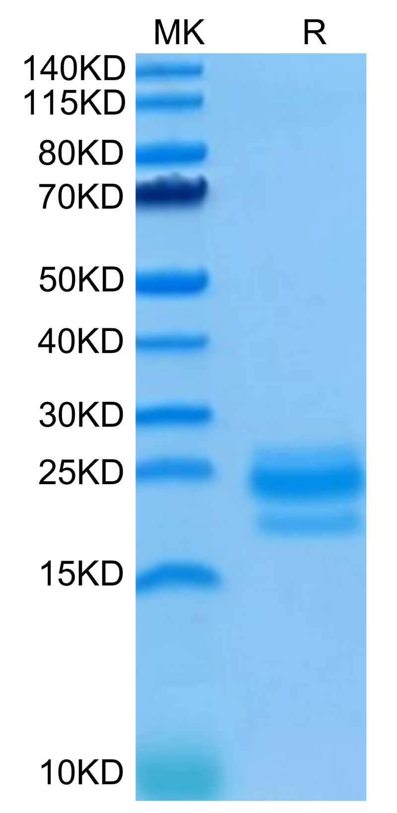Human CD99 on Tris-Bis PAGE under reduced condition. The purity is greater than 95%.Recombinant Human CD99/MIC2 Protein
