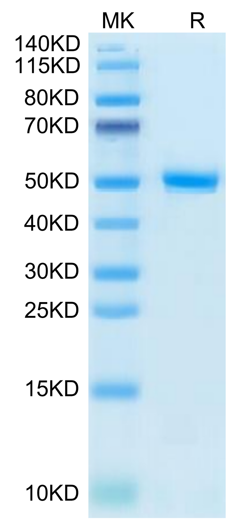 Human CD99 on Tris-Bis PAGE under reduced condition. The purity is greater than 95%.Recombinant Human CD99/MIC2 Protein
