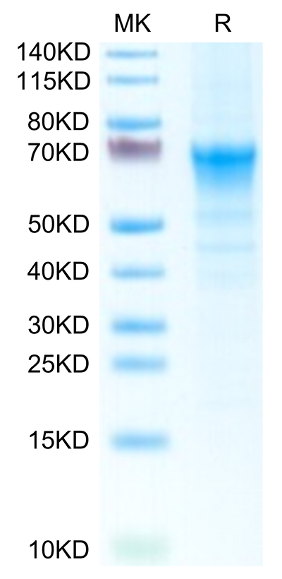 Mouse CRTAM on Tris-Bis PAGE under reduced condition. The purity is greater than 95%.Recombinant Mouse CRTAM Protein
