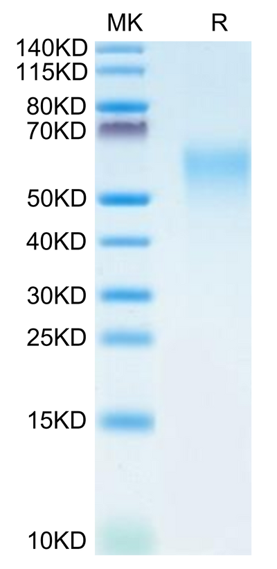 Human CRTAM on Tris-Bis PAGE under reduced condition. The purity is greater than 95%.Recombinant Human CRTAM Protein, Active