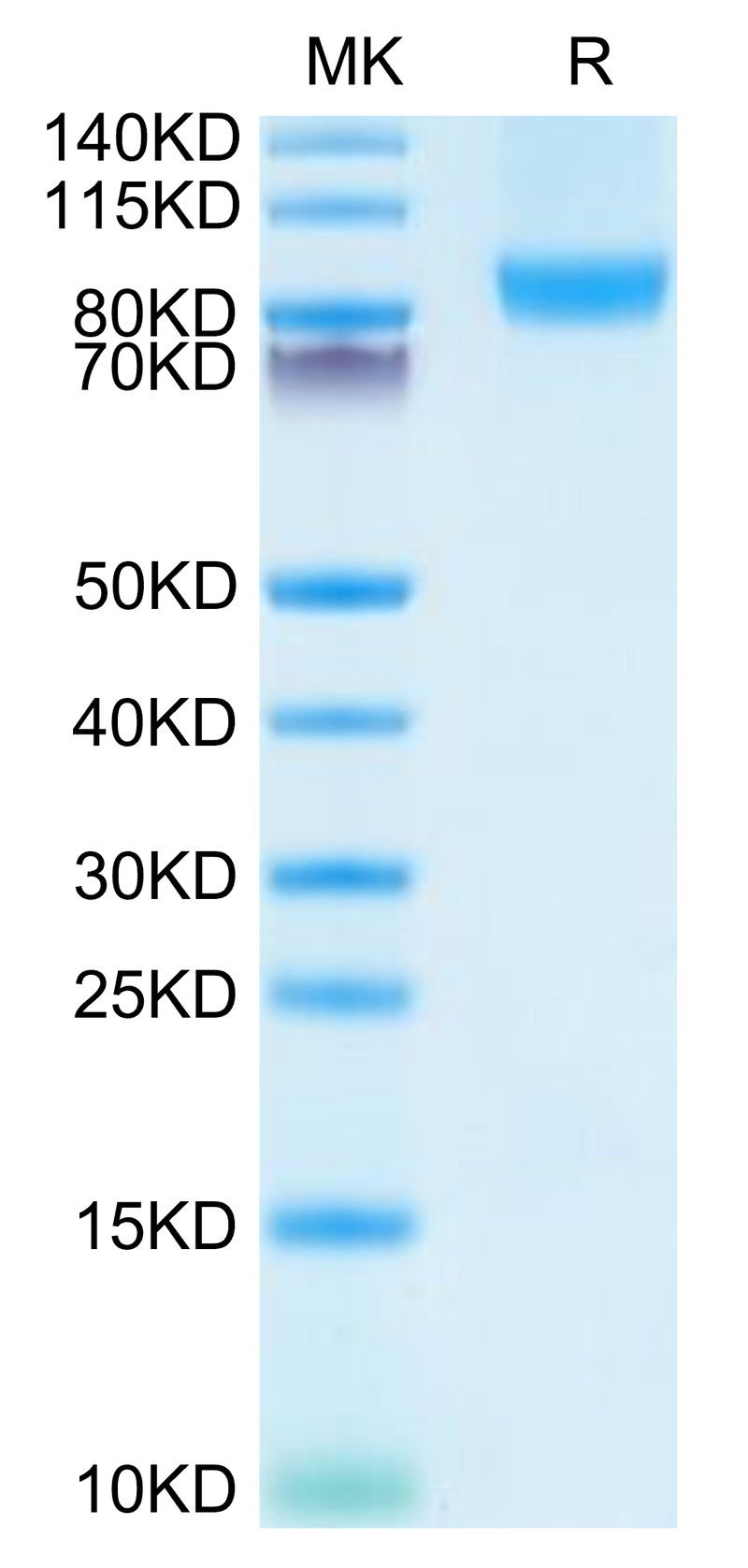 Human CD31 on Tris-Bis PAGE under reduced condition. The purity is greater than 95%.Recombinant Human CD31/PECAM-1 Protein